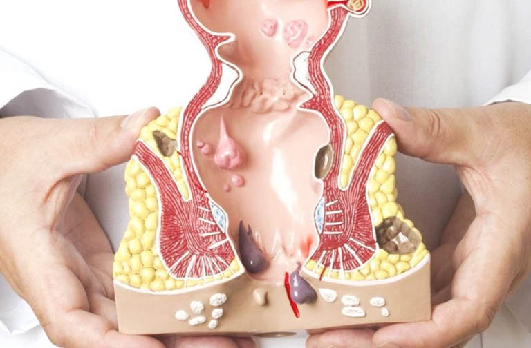 Tiến hành giảm thiểu nguy cơ và triệu chứng của bệnh